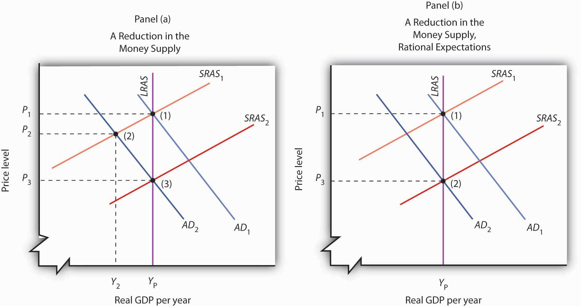 contractionary gap