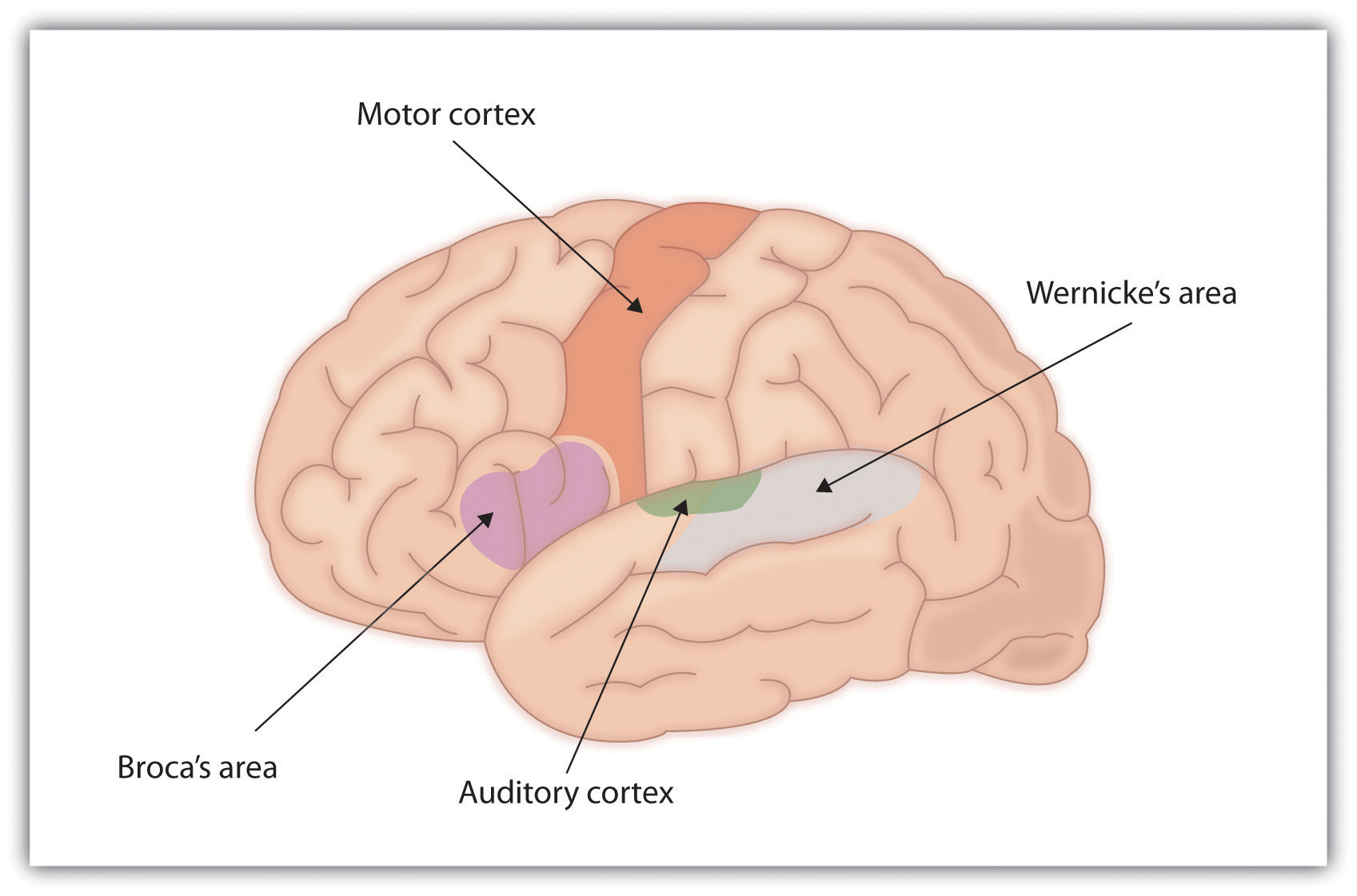 Auditory Cortex Location