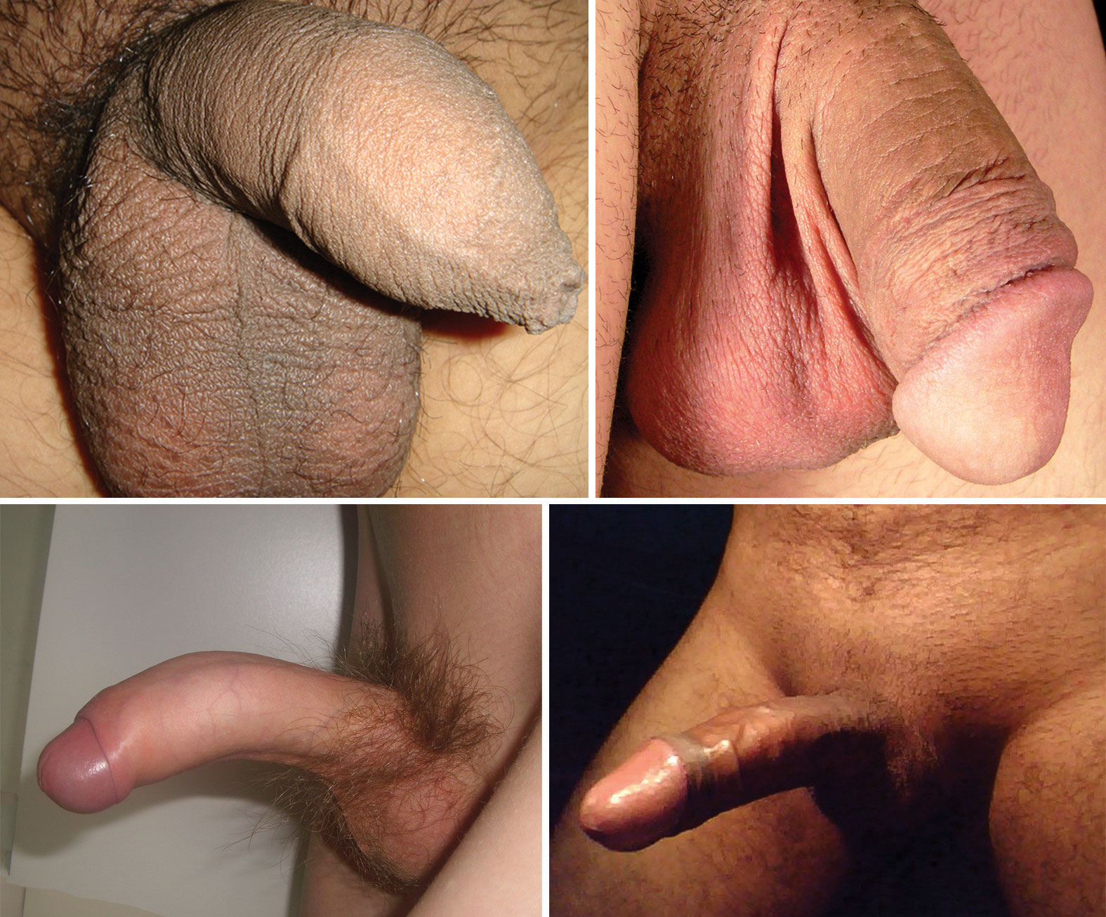 Uncircumcised men naked