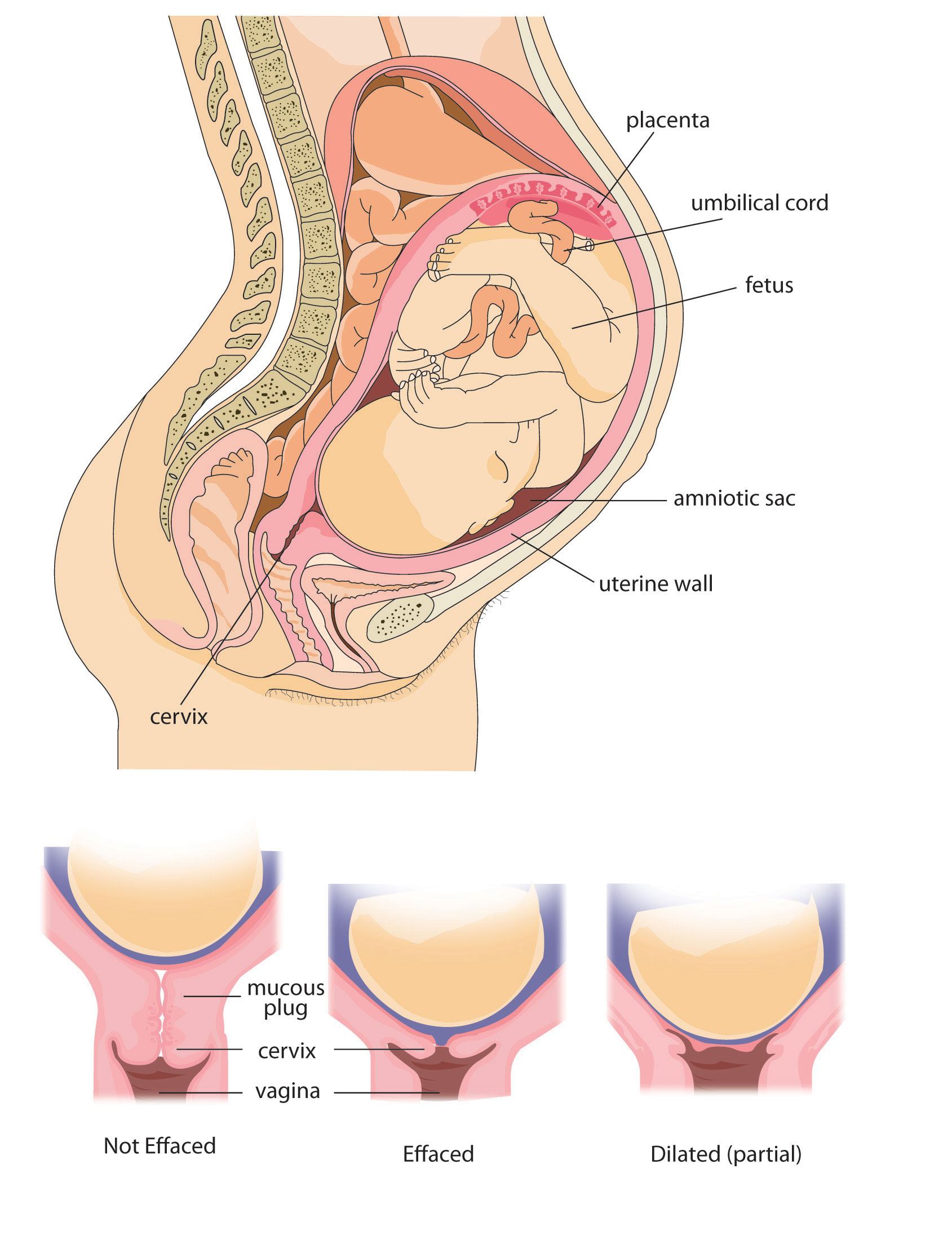 2 Cm Dilated 50 Effaced 38 Weeks